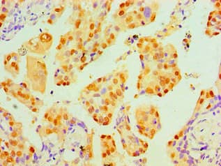 TP53 / p53 Antibody (clone 6H5E7)