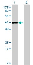 PBX2 Antibody (clone 2E9)