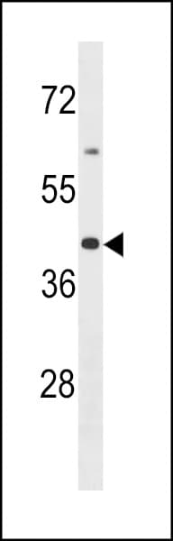 OR2B6 Antibody (aa208-236)