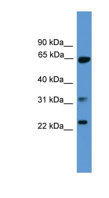Polyclonal Rabbit anti-Human CLTA / LCA Antibody (aa141-190, IHC, WB)