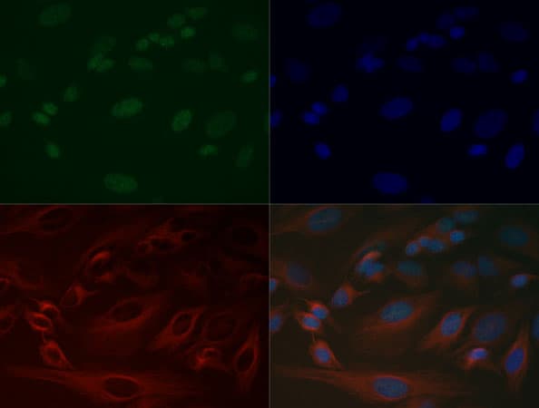 Polyclonal Rabbit anti-Human HIST3H3 Antibody (Me-Lys37, IF, WB)