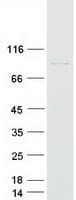 Human NUP93 Protein (Recombinant Myc-DDK (Flag))