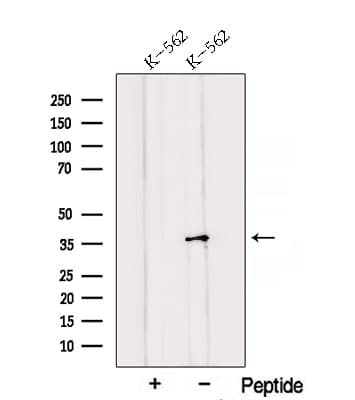 Polyclonal Rabbit anti-Human QKI Antibody (IF, WB)