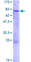 Human ELK3 / NET Protein (Recombinant GST)