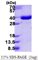 Human ANXA10 / Annexin A10 Protein (Recombinant His)