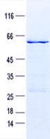 Human CISH / SOCS Protein (Recombinant GST, N-terminus + His, C-terminus)