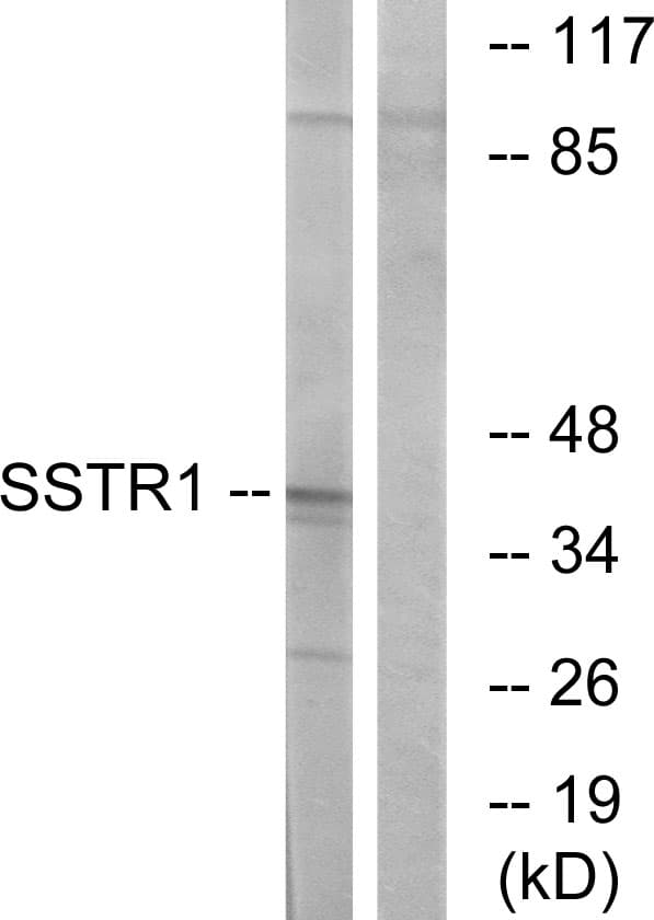 SSTR1 Antibody (aa9-58)