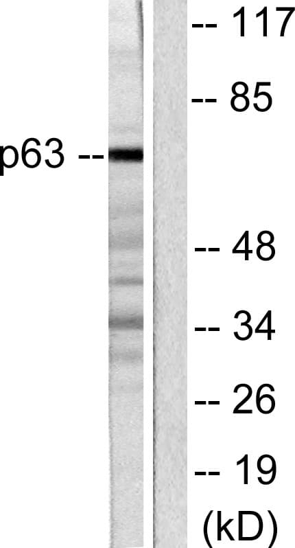 IHC-plus™ TP63 / p63 Antibody (C-Terminus)