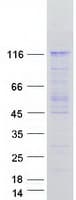 Human USP1 Protein (Recombinant Myc-DDK (Flag))
