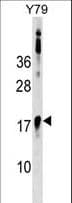 BCL7B Antibody (aa137-164)