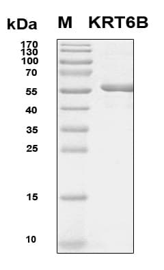 Human KRT6B / CK6B / Cytokeratin 6B Protein (Recombinant 6His, N-terminus)