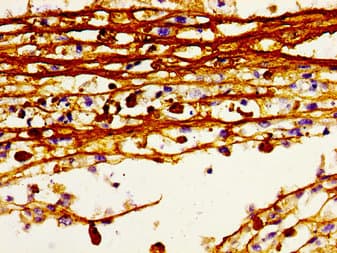 Polyclonal Rabbit anti-Human HDC / Histidine Decarboxylase Antibody (IHC, WB)
