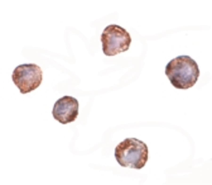 IHC-plus™ XBP1 Antibody (clone 3H1G4)