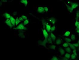 SMS / Spermine Synthase Antibody (clone OTI5C12)