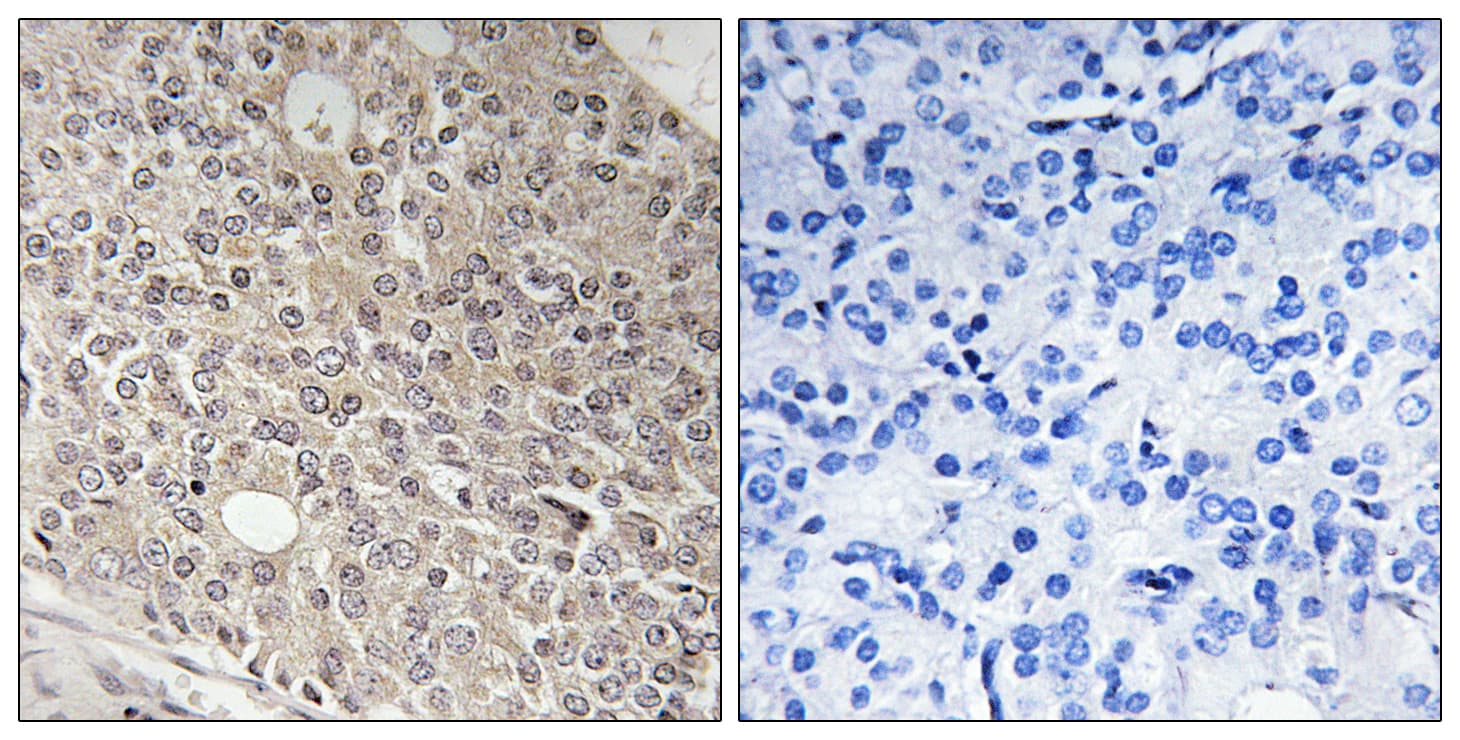 Polyclonal Rabbit anti-Human JEAP / AMOTL1 Antibody (aa441-490, IHC)