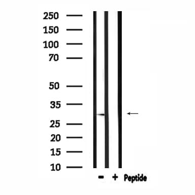 RAB29 / RAB7L1 Antibody
