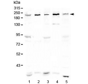 ASXL1 Antibody
