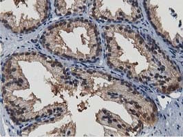 ERIC-1 / TACC3 Antibody (clone OTI3B1)