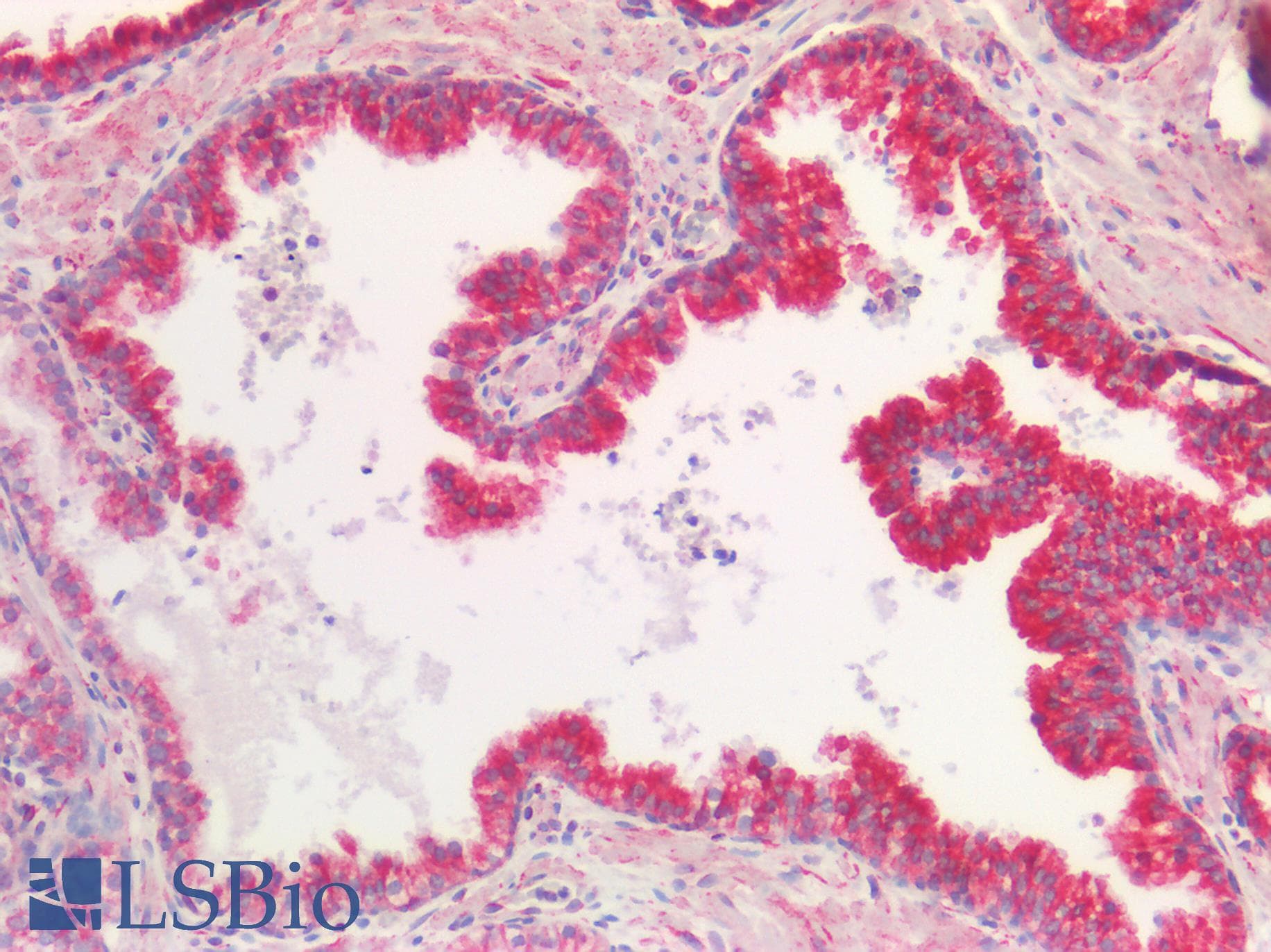 Polyclonal Rabbit anti-Human TUBB / Beta Tubulin Antibody (IHC, WB)