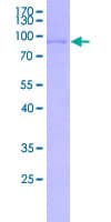 Human CYP21A2 Protein (Recombinant GST)