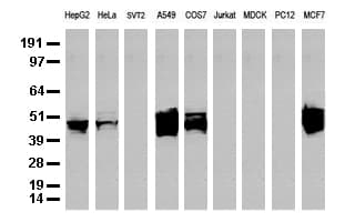 KRT18 / CK18 / Cytokeratin 18 Antibody (aa69-372, clone UMAB50)