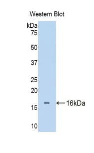 SLIT3 Antibody (aa1449-1523)