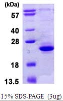 Human TIFA Protein (Recombinant His)