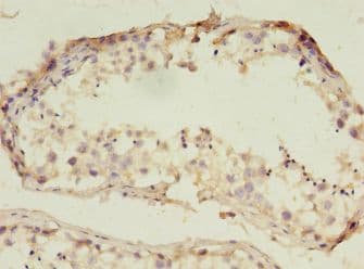 RNF133 Antibody (Biotin)