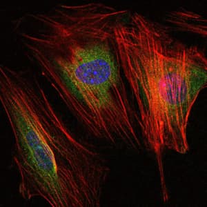 Monoclonal Mouse anti-Human MMP9 / Gelatinase B Antibody (clone 5G3, IHC, IF, WB)