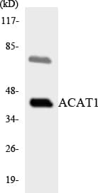 ACAT1 Antibody (aa217-266)