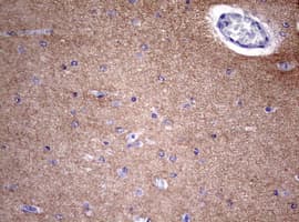 VILIP / VSNL1 Antibody (aa2-191, clone OTI7E12)