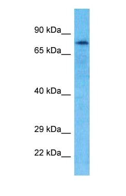 GPAT2 Antibody (N-Terminus)