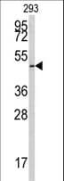 IHC-plus™ E2F1 Antibody (Ser332)