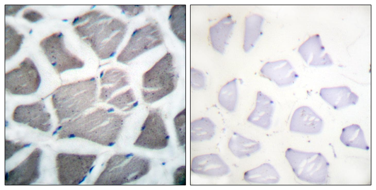 Polyclonal Rabbit anti-Human BAK1 / BAK Antibody (IHC, WB)