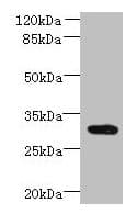 CCDC127 Antibody (Coiled-coil domain)