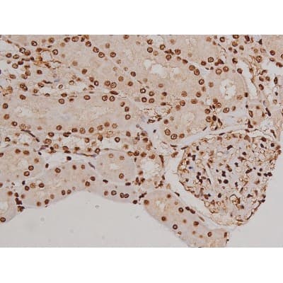 FAK / Focal Adhesion Kinase Antibody (phospho-Tyr397)