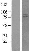 VPS41 Protein (Over-Expression Lysate Myc-DDK (Flag))
