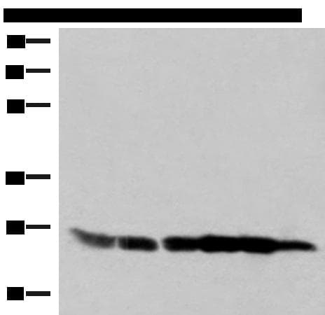 GSTK1 Antibody