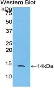 CCL24 / Eotaxin 2 Antibody (aa27-119)