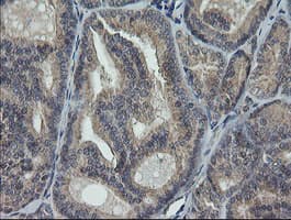 RAB30 Antibody (clone OTI1B2)