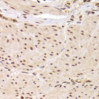 Polyclonal Rabbit anti-Human RBPJ Antibody (IHC, IF, WB)