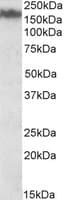 PathPlus™ NEFM / NF-M Antibody (aa250-263)
