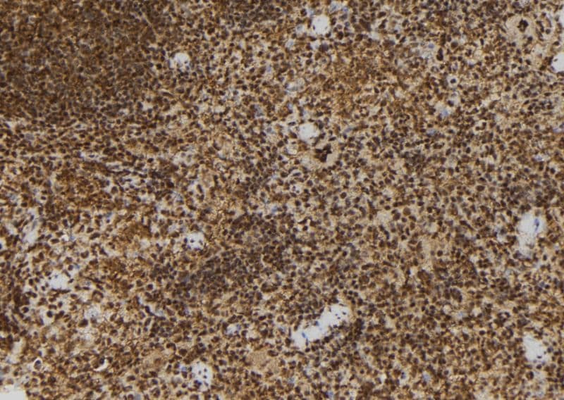 Polyclonal Rabbit anti-Human ADRM1 Antibody (IHC, IF, WB)