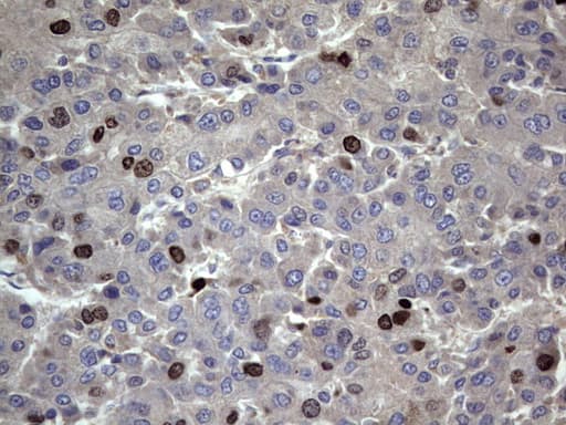 MKI67 / Ki67 Antibody (aa1160-1493, clone OTI1D9)