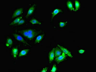 ETNK1 / Ethanolamine Kinase 2 Antibody