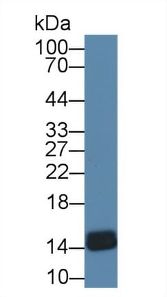 FABP4 / AP2 Antibody (aa1-125, Biotin)