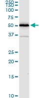 Monoclonal Mouse anti-Human P5CDH / ALDH4A1 Antibody (clone 1A12-A5, IHC, WB)