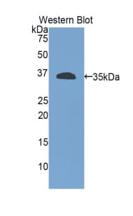 ITGB4 / Integrin Beta 4 Antibody (aa923-1197)