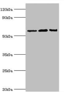 Polyclonal Rabbit anti-Human IL10RA Antibody (aa22-230, IHC, WB)