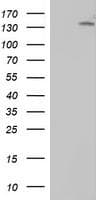 Monoclonal Mouse anti-Human ERBB2 / HER2 Antibody (clone OTI1C5, Carrier-free, aa676-1255, IHC, IF, WB)